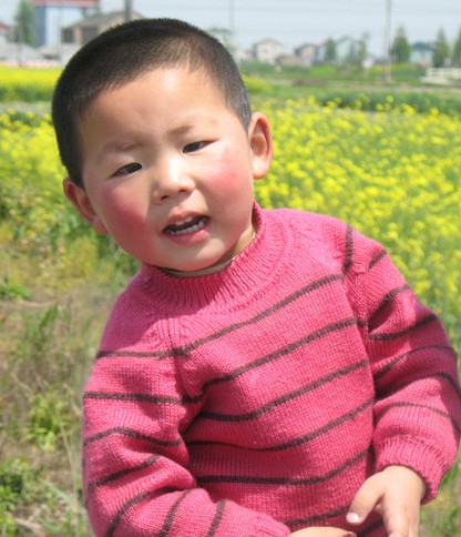 兒童癲癇 兒童癲癇病的飲食方法與護(hù)理