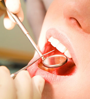 口腔健康常識 拔牙后需要注意哪些事項