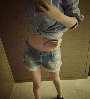 反手摸到肚臍就是好身材  過度減肥的危害