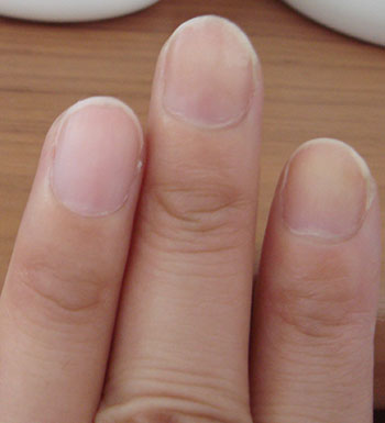 健康自測有妙招 皮膚和指甲告訴你身體狀況