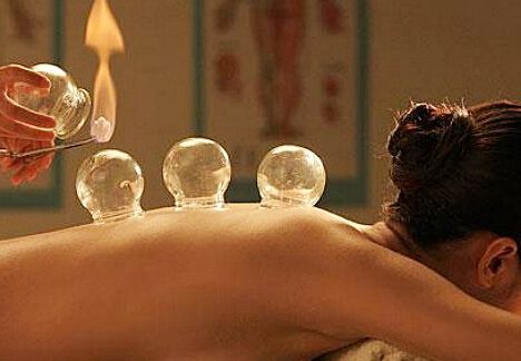 中醫(yī)拔罐的種類以及功效你了解嗎