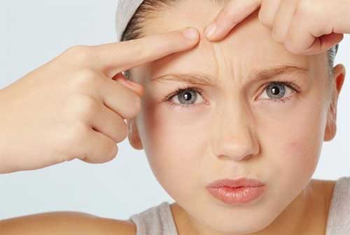 額頭長痘痘怎么辦，以下方法教你怎么滅痘