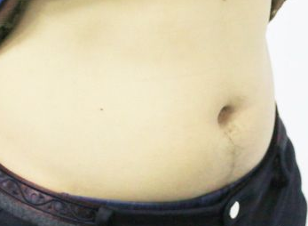 如何瘦肚子，教你怎么告別游泳圈