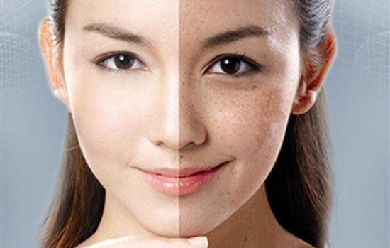 能淡化色斑的食物 吃什么淡化色斑
