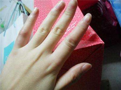 討厭的疤痕快走開，怎么修復(fù)疤痕