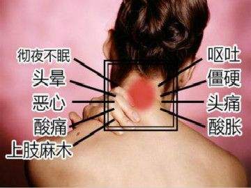 頸椎病有什么癥狀，這幾種癥狀你要知道