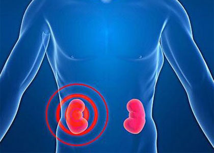 吃什么食物補(bǔ)腎你都知道嗎