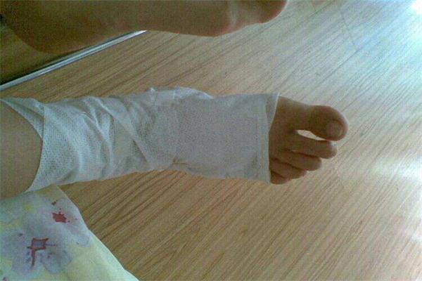 腳腫了怎么辦 腳腫的原因