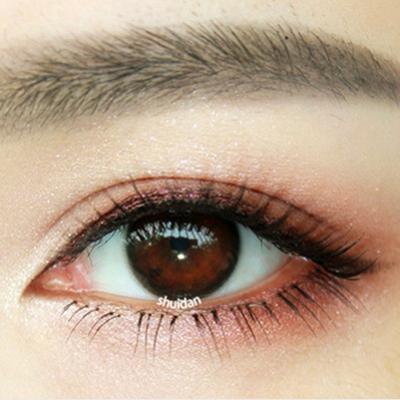 美瞳的危害  佩戴美瞳導(dǎo)致眼睛缺氧