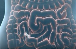 腸鏡檢查 六種方法你懂嗎