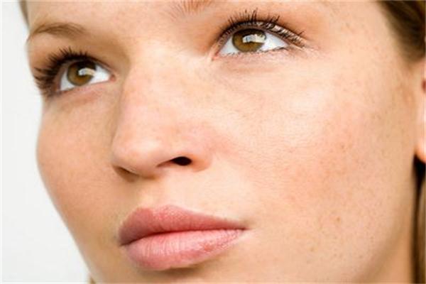 臉上有斑怎么辦 教您小妙招輕松去除