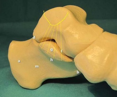 跟骨骨膜炎患者如何治療更有效