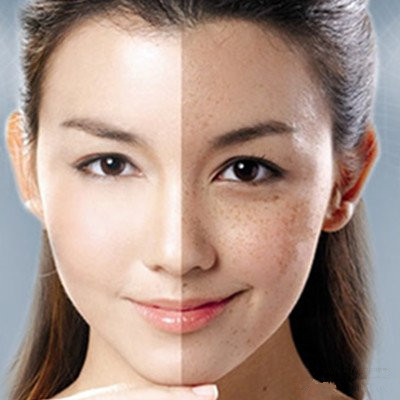 我有斗斑法寶，教你怎么自制祛斑面膜