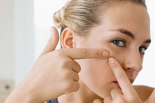 痤瘡怎樣治 日常護(hù)理和藥物治療方法