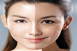 我有斗斑法寶，教你怎么自制祛斑面膜