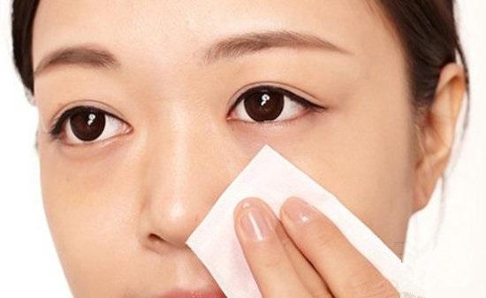 黑頭怎么去除 這些辦法省時又省力