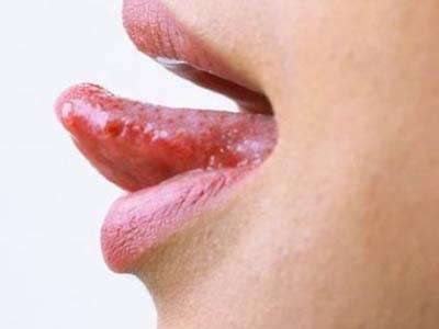 為什么會(huì)上火 教你出現(xiàn)上火怎么辦