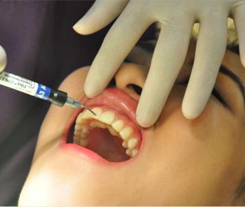 牙齦炎癥狀 這5大表現(xiàn)你要小心