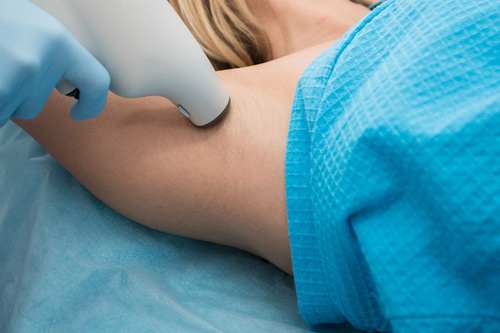 腋毛怎么處理 小編教您四個小方法