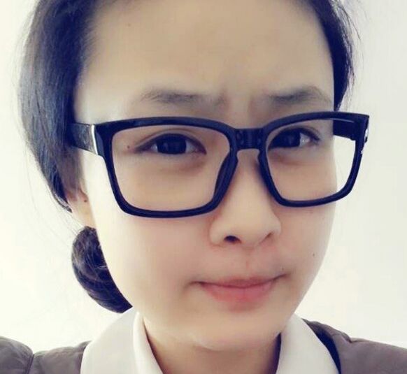 青少年近視防治需了解的幾個要點