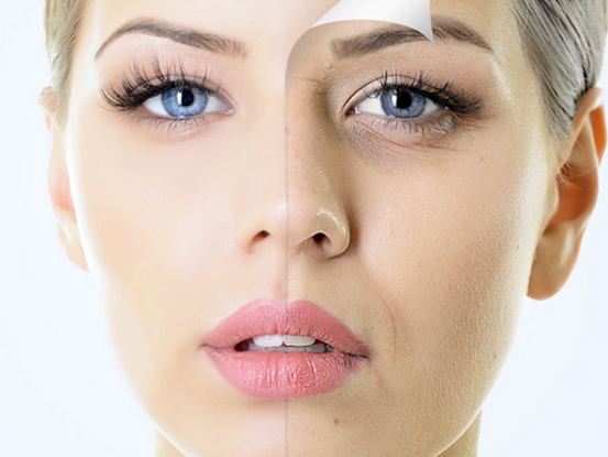 年輕人最想知道怎么樣才能消除眼袋