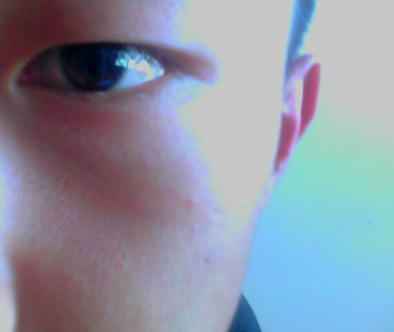 如何治療眼袋 去除眼袋的8大步驟