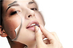 吃什么水果可以去斑 四種水果吃法