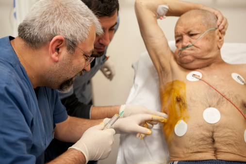 肺癌的晚期癥狀 一般表現(xiàn)在四個(gè)方面