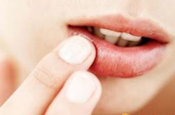 嘴上起泡怎么回事 并非上火那么簡(jiǎn)單