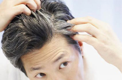 導(dǎo)致年輕人長(zhǎng)白頭發(fā)的三大原因介紹