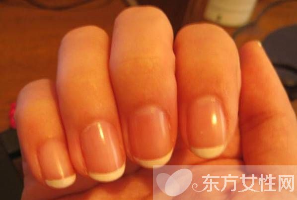 灰指甲會傳染嗎 灰指甲的護(hù)理方法