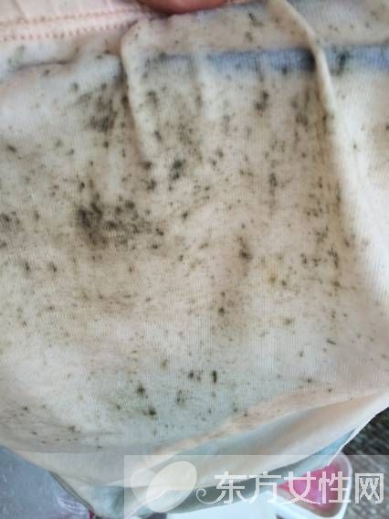 衣服發(fā)霉該如何清洗 3種簡便方法一招搞定