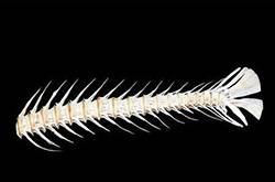 魚(yú)刺卡住了怎么辦 9種小妙招讓你很快消除魚(yú)刺