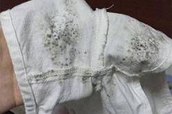 衣服發(fā)霉該如何清洗 3種簡(jiǎn)便方法一招搞定
