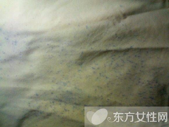 衣服發(fā)霉該如何清洗 3種簡便方法一招搞定