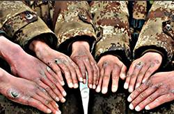 怎么治凍瘡 幾招教你怎樣預防凍瘡