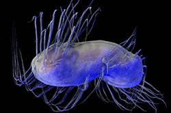 幽門(mén)螺旋桿菌感染 4大預(yù)防方法需做好