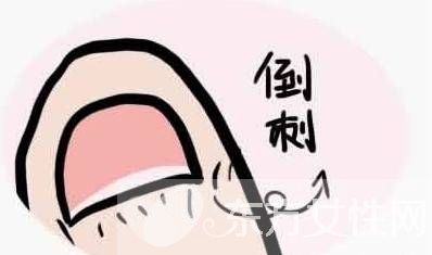 倒刺是什么 指甲倒刺的預(yù)防