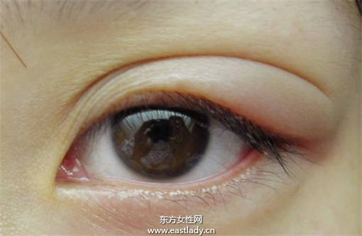 偷看別人洗澡會長針眼 科學(xué)讓你知道為什么會長針眼