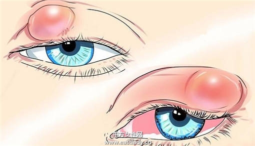 偷看別人洗澡會長針眼 科學(xué)讓你知道為什么會長針眼