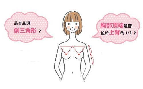 胸外擴(kuò)可以糾正過(guò)來(lái)嘛 產(chǎn)后美胸還你自信美麗人生