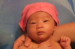 母乳性黃疸怎么治療 如何預防嬰兒母乳性黃疸