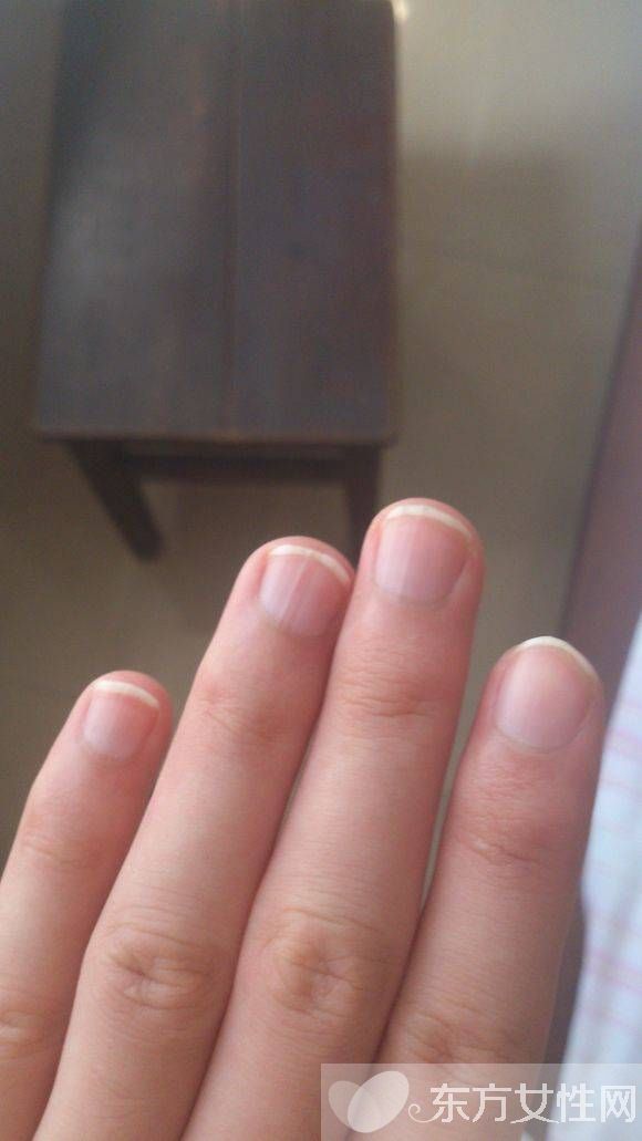 你健康嗎 指甲半月痕反映你的健康狀況
