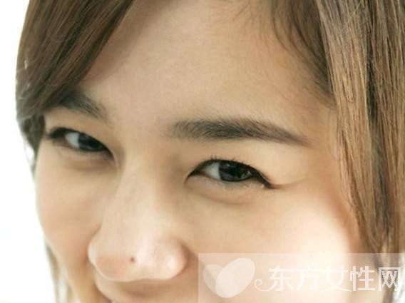 眼袋是怎么形成的 這些小妙招可以有效去除眼袋哦