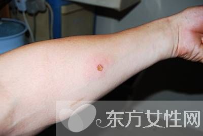 守宮砂是什么 守宮砂的歷史傳說