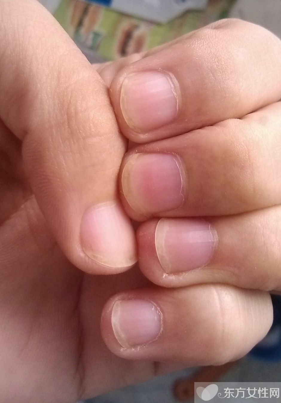 你健康嗎 指甲半月痕反映你的健康狀況