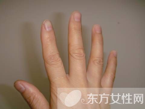 你健康嗎 指甲半月痕反映你的健康狀況