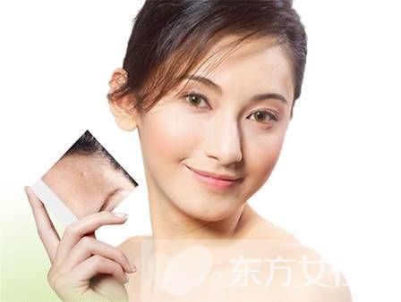 什么方法最快去痘印 溫馨小提示不可忘哦