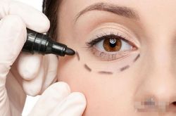 眼袋是怎么形成的 這些小妙招可以有效去除眼袋哦