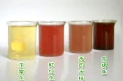 女人小便很黃怎么回事 怎么從尿的顏色看健康